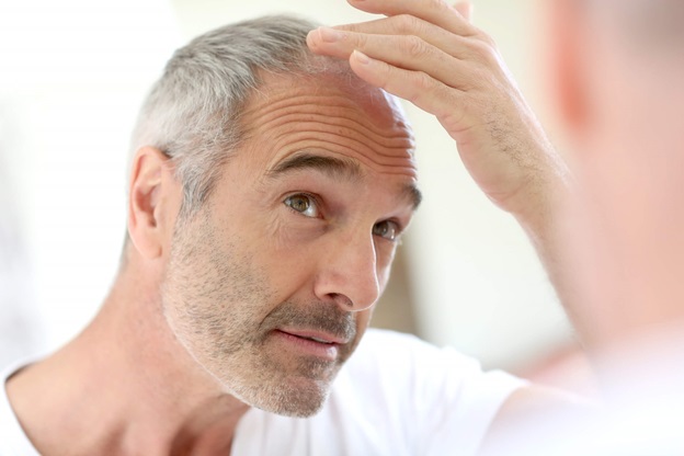 How To Stop Hair Fall and Balding