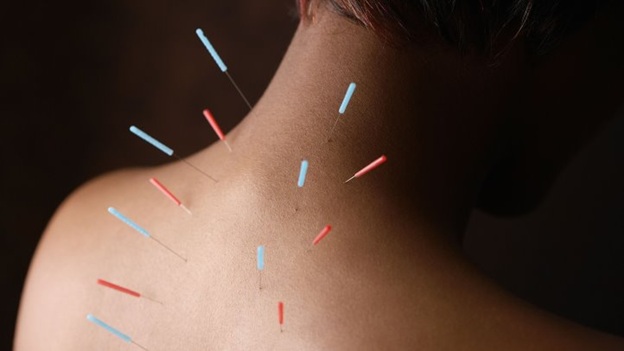 Acupuncture for Pain Management – Why Does It Work?