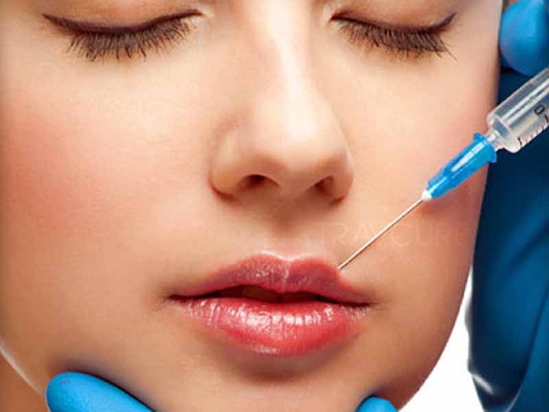 4 TOP REASONS TO CHOOSE LIP INJECTIONS