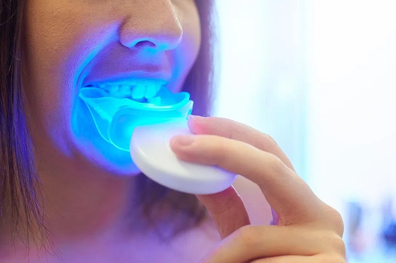Dramatic and Instantaneous Results With Teeth Whitening Products
